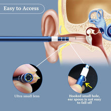 Load image into Gallery viewer, Premium Digital Phone Otoscope Camera 3 in 1