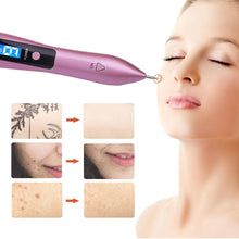 Load image into Gallery viewer, Skin Tag Removal Mole Plasma Pen