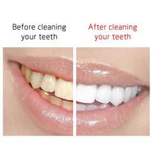 Load image into Gallery viewer, Dental Ultrasonic Plaque/Tartar Scaler & Calculus Stain Remover