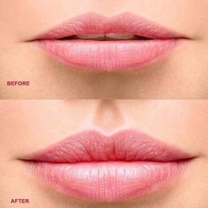 Natural Kylie Lip Plumper Device Automatic Handheld Lip Enhancer Tool