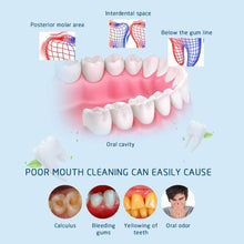 Load image into Gallery viewer, Dental Ultrasonic Plaque/Tartar Scaler &amp; Calculus Stain Remover
